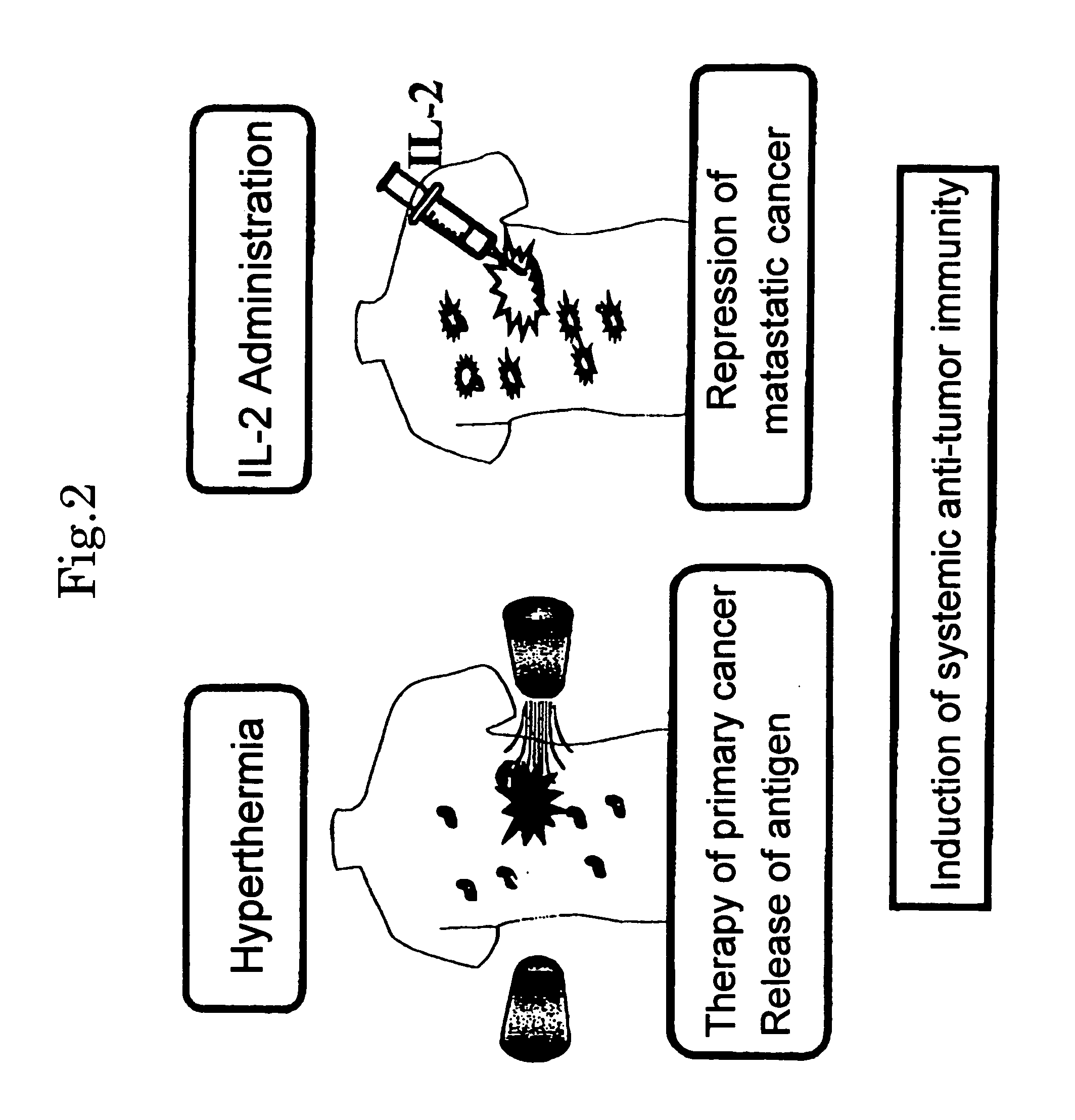 Hyperthermia agent for malignant tumor comprising cytokine and magnetic fine particles