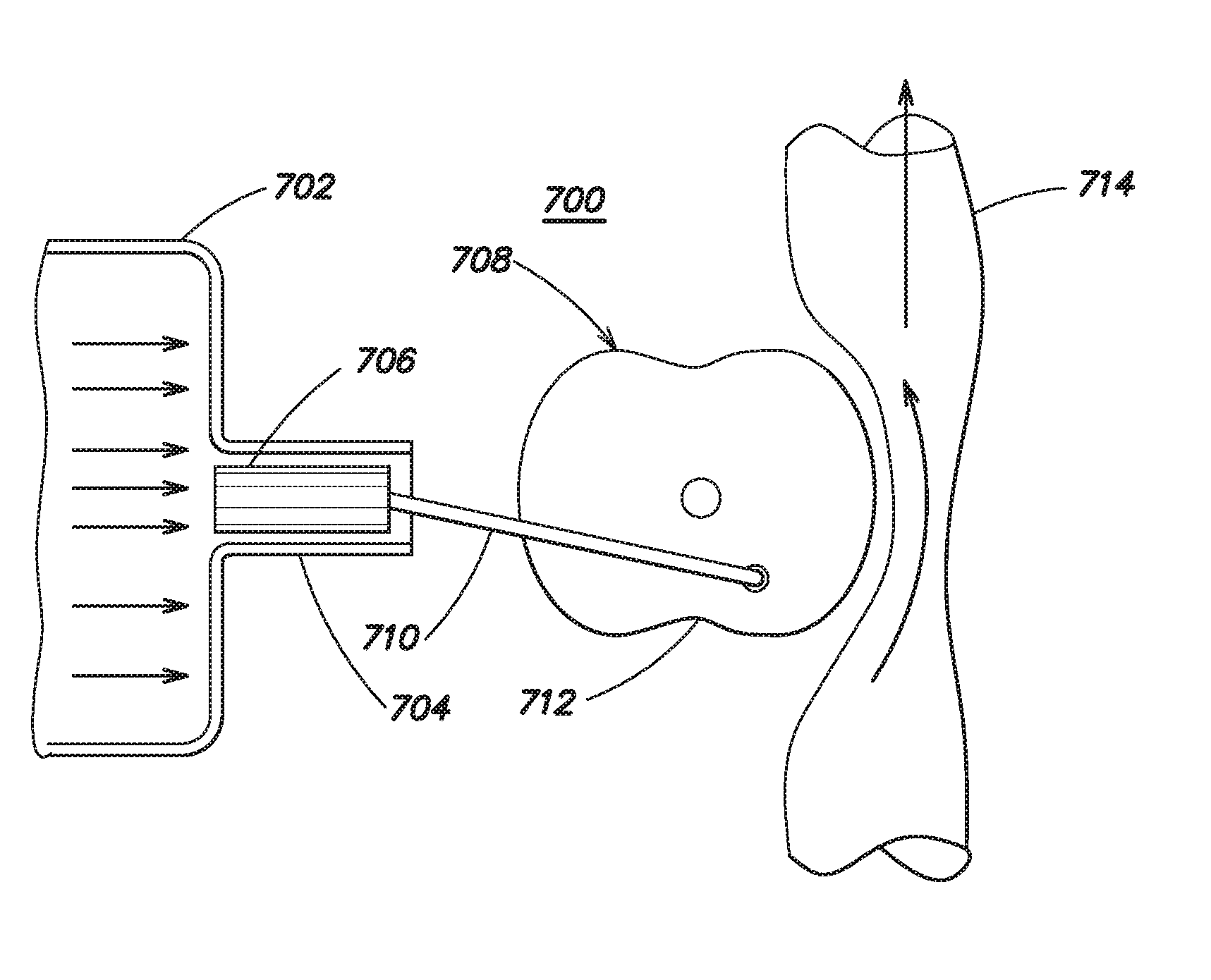 System for producing continuous mechanical energy to treat heart failure without the use of external energy source