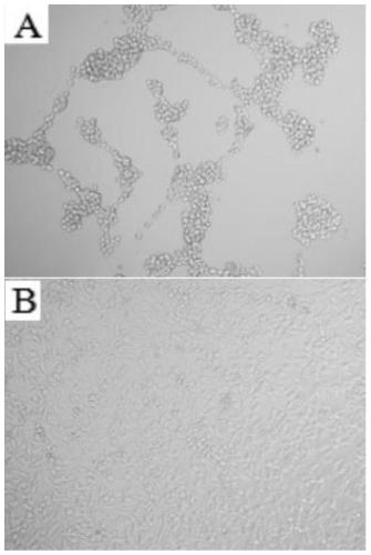 Bacillus CCPM7645 with strong anti-cancer activity and application thereof