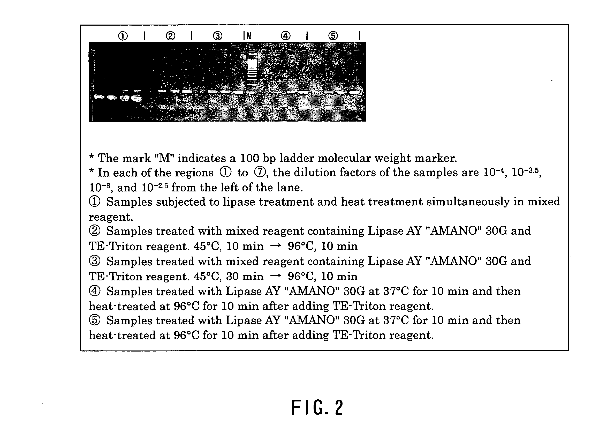 Method of effecting lysis of acid-fast bacteria and method of performing gene amplification or detection therewith