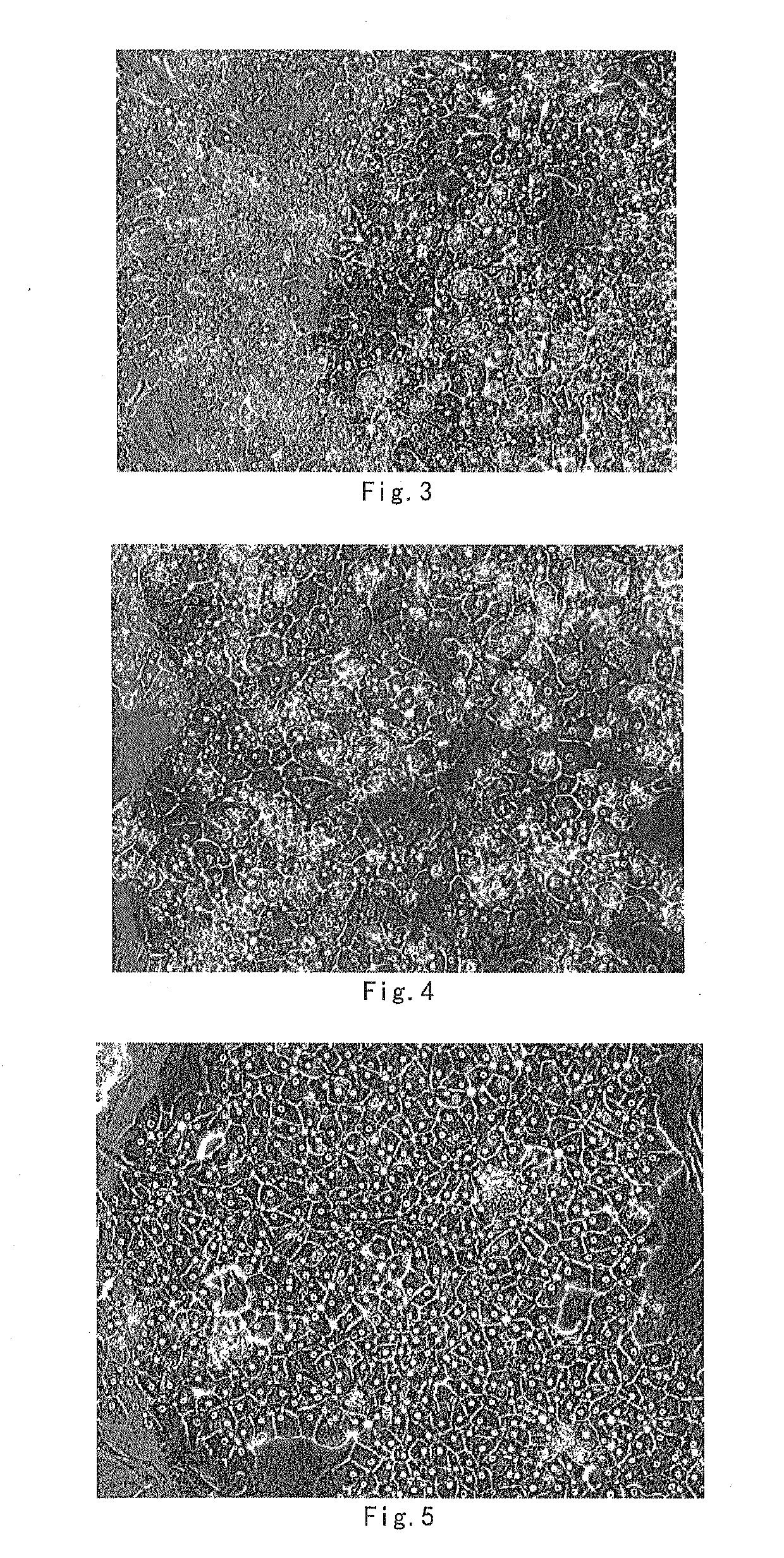 Culture method for long-term maintenance and proliferation subculture of human hepatocytes