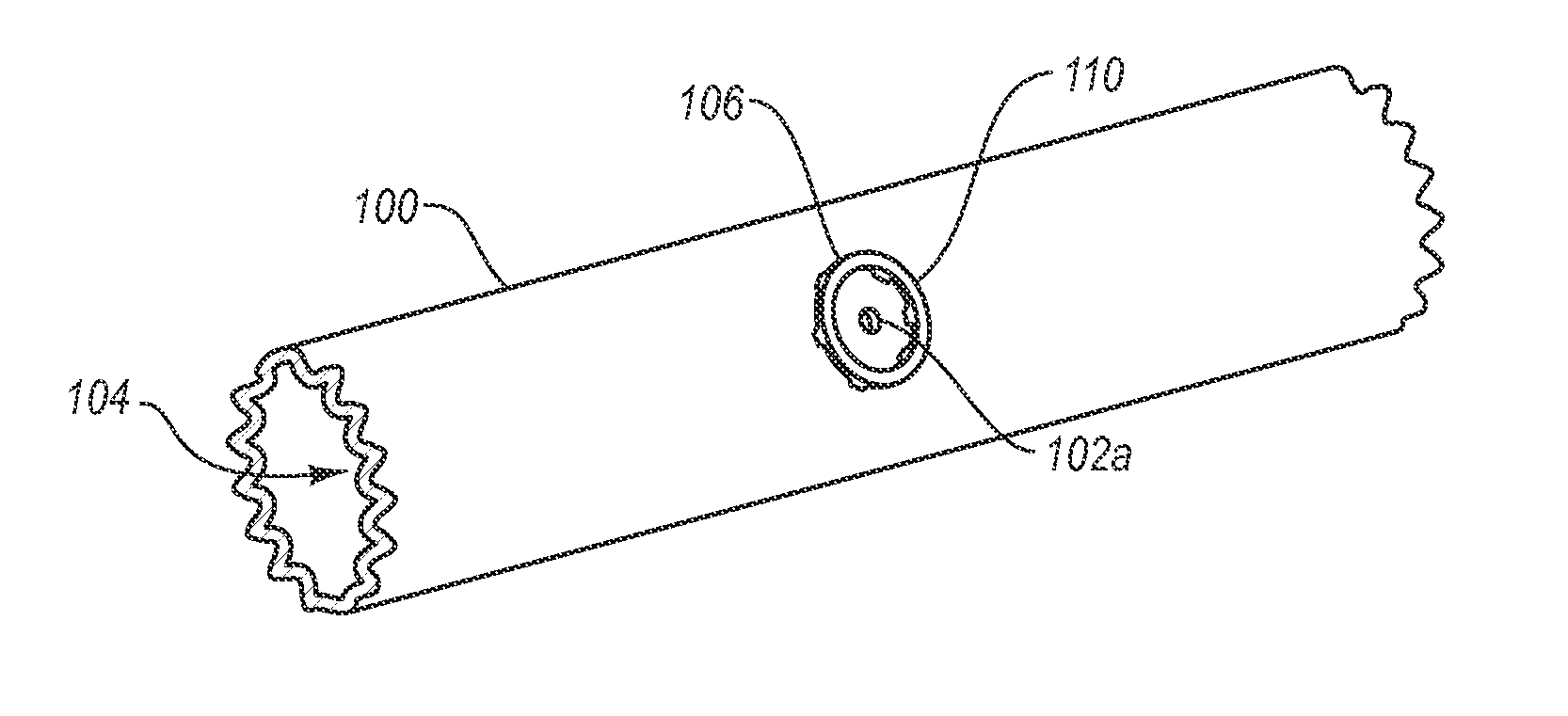 Scaffold device for preventing tissue trauma