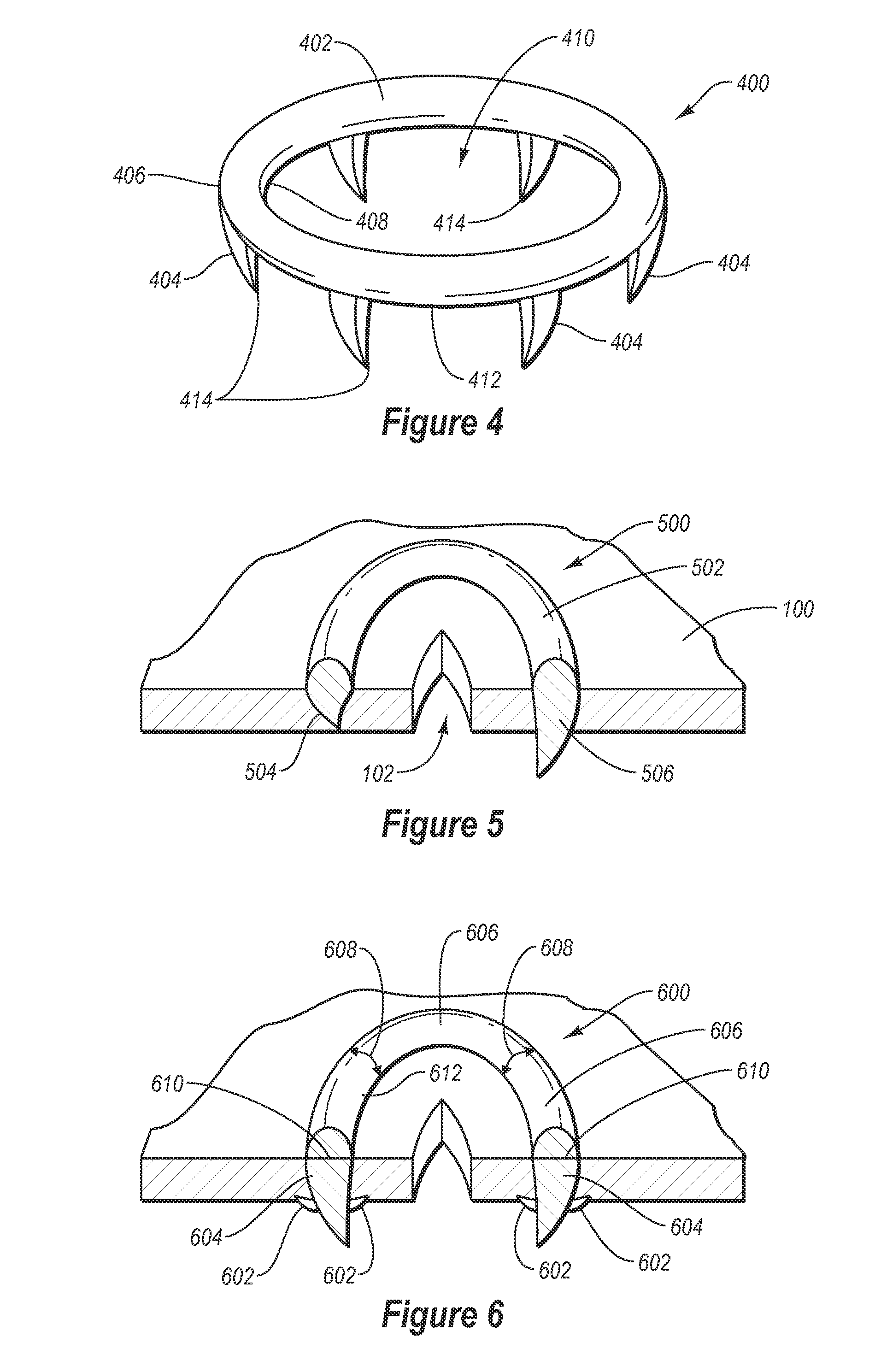 Scaffold device for preventing tissue trauma