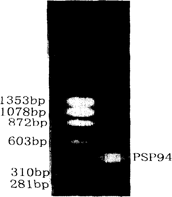Method for recombining human PSP94 protein secretory expression in colibacillus