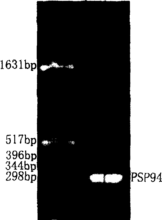 Method for recombining human PSP94 protein secretory expression in colibacillus