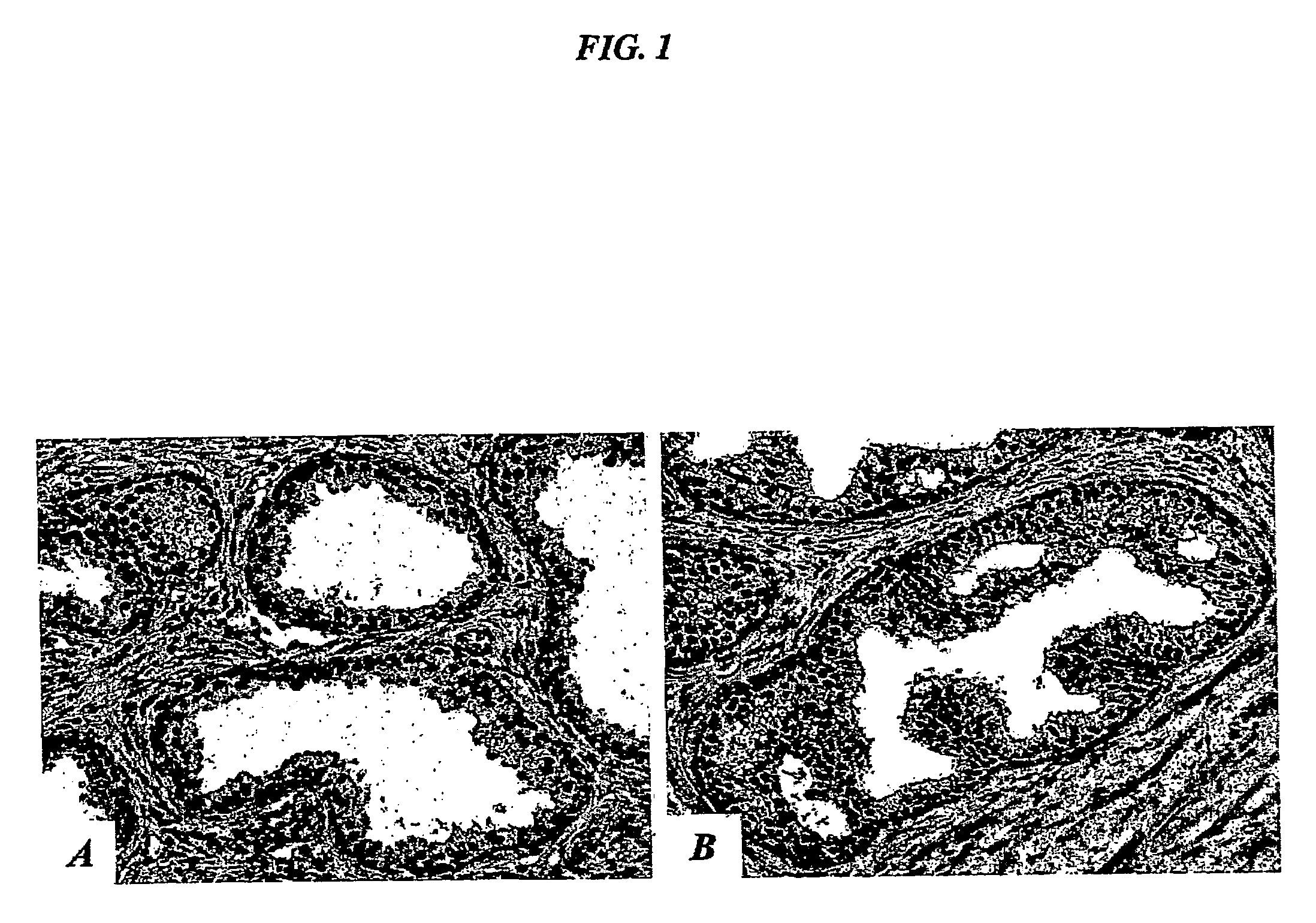 Compositions and methods of use of targeting peptides for diagnosis and therapy of human cancer