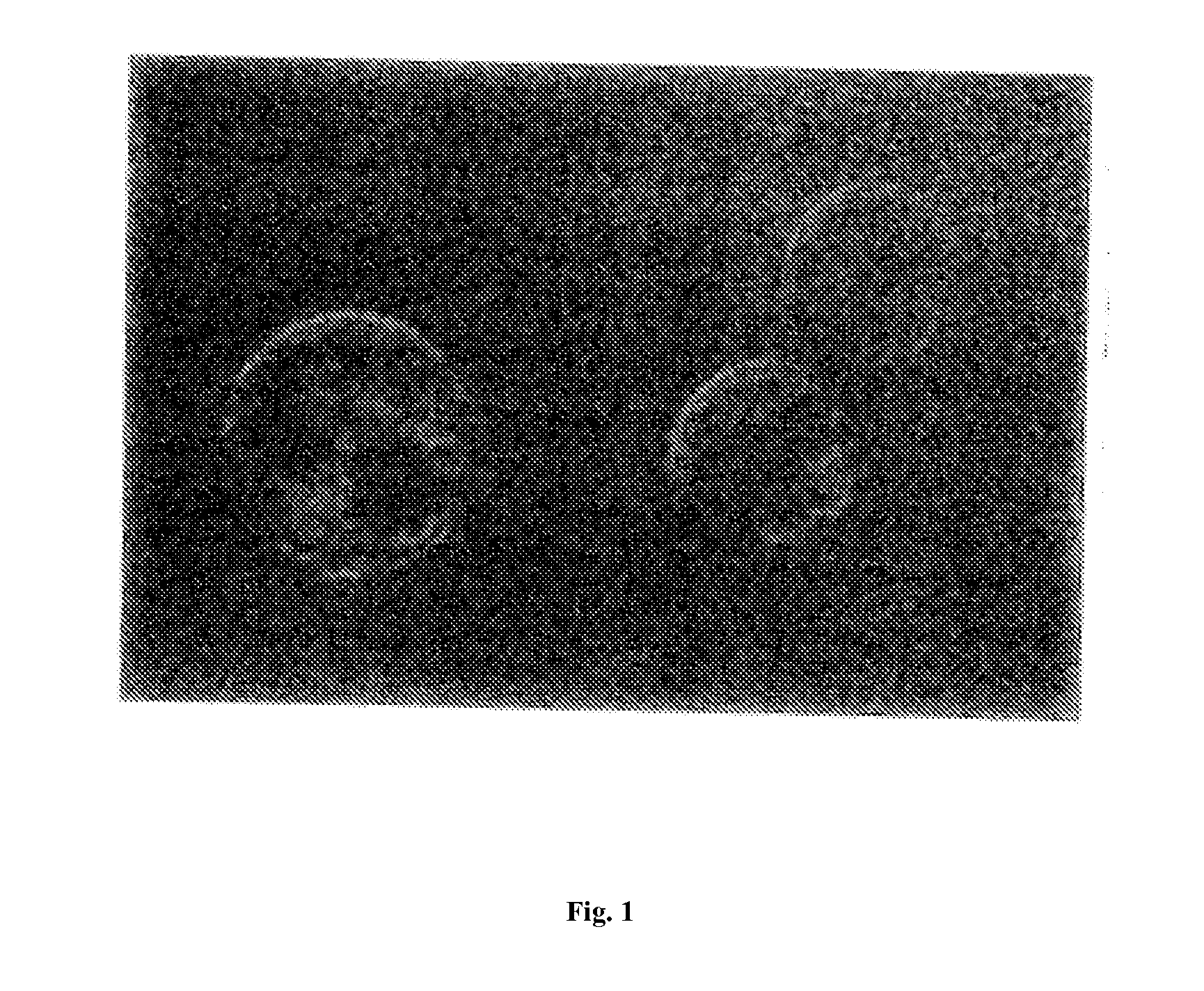 Bank of stem cells for producing cells for transplantation having HLA antigens matching those of transplant recipients, and methods for making and using such a stem cell bank
