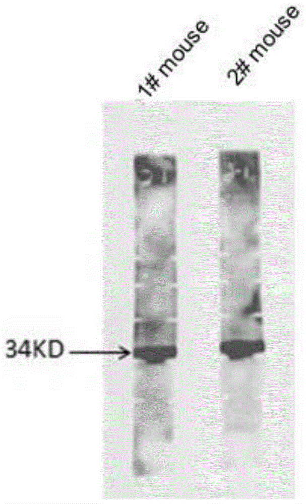 Preparation and application of a kind of human icf45 monoclonal antibody