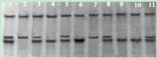 DNA silver staining method in polyacrylamide gel electrophoresis