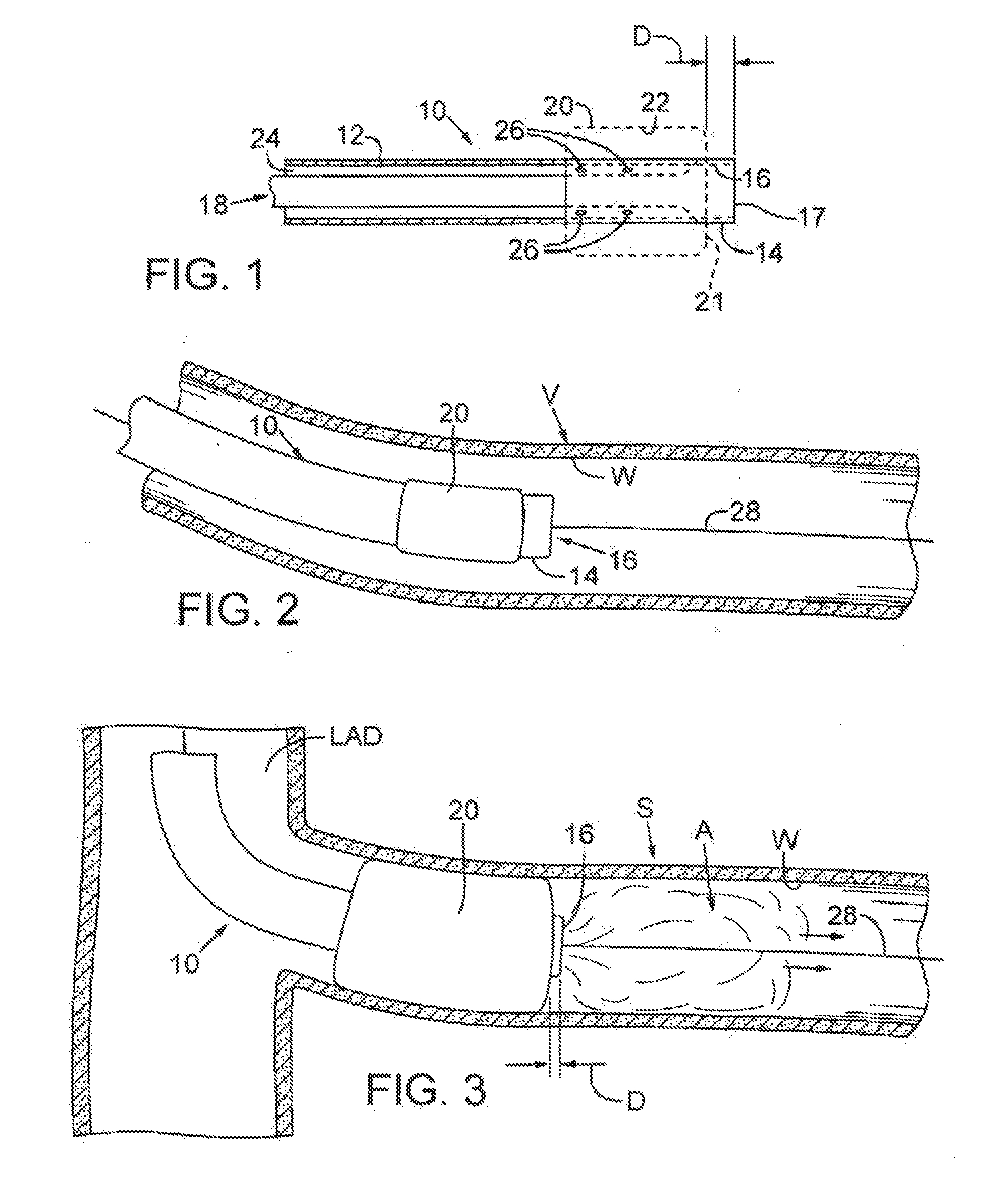 Device for treating chronic total occlusion