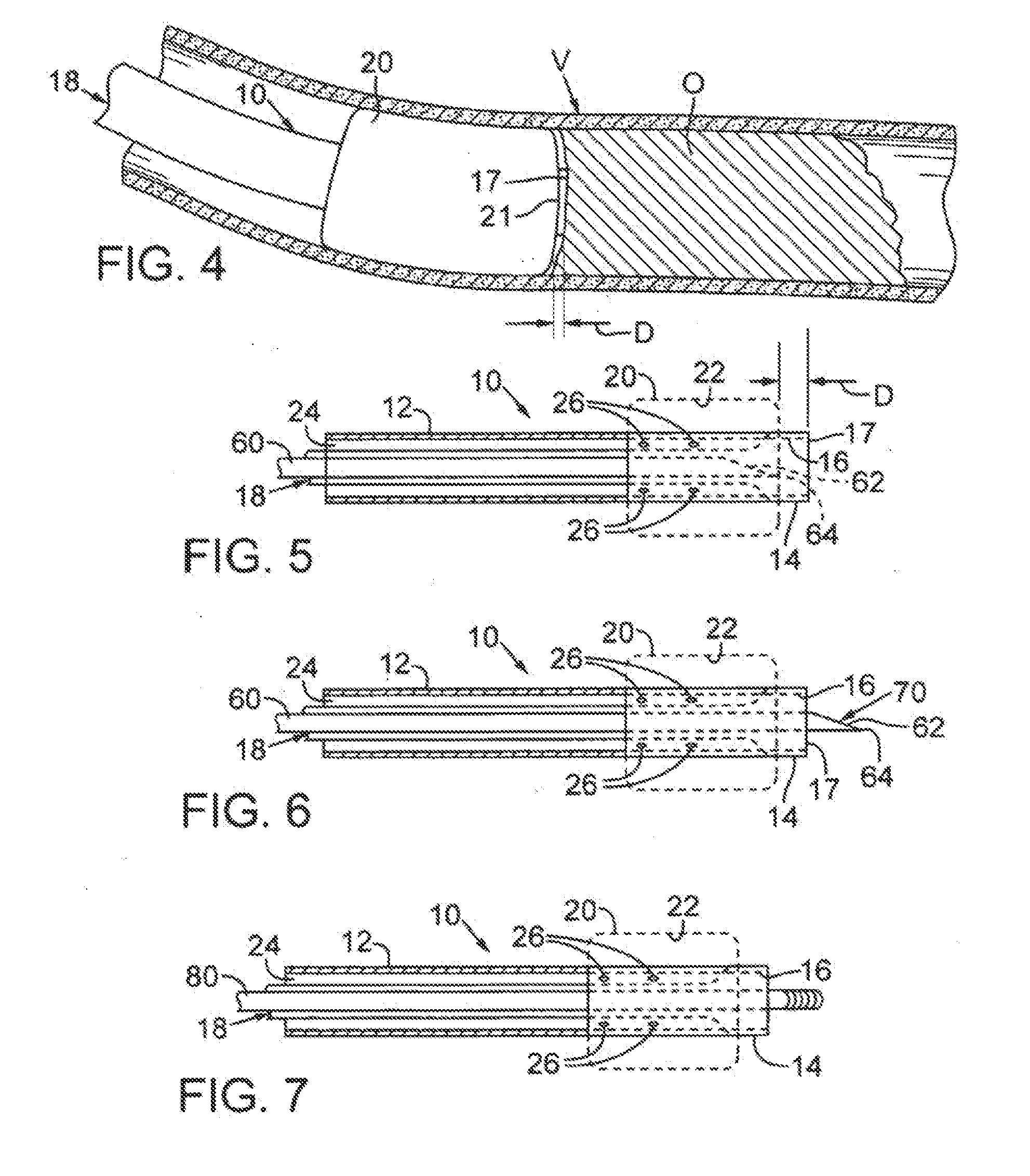 Device for treating chronic total occlusion