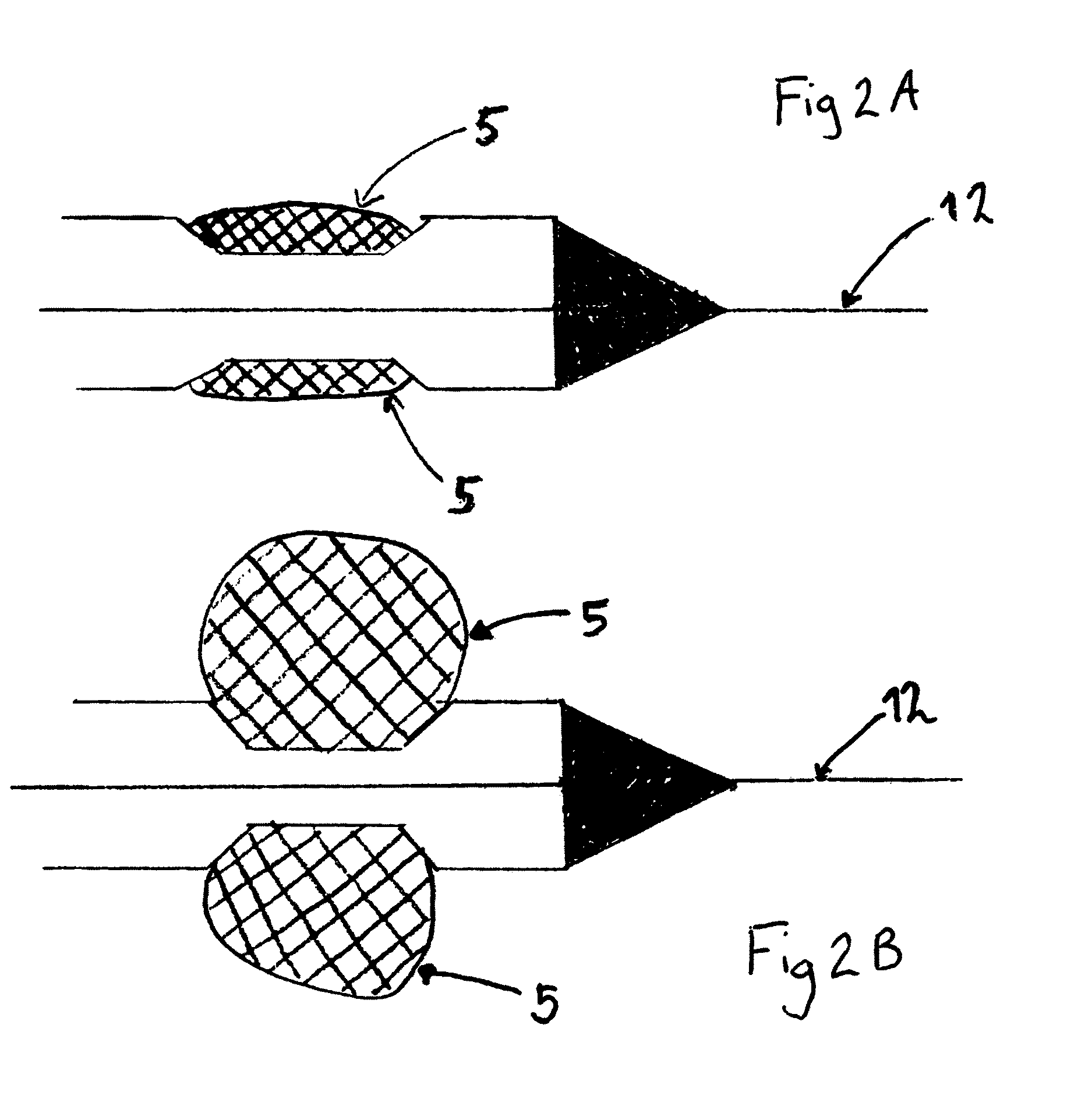 Method for delivery of an embolic protection unit