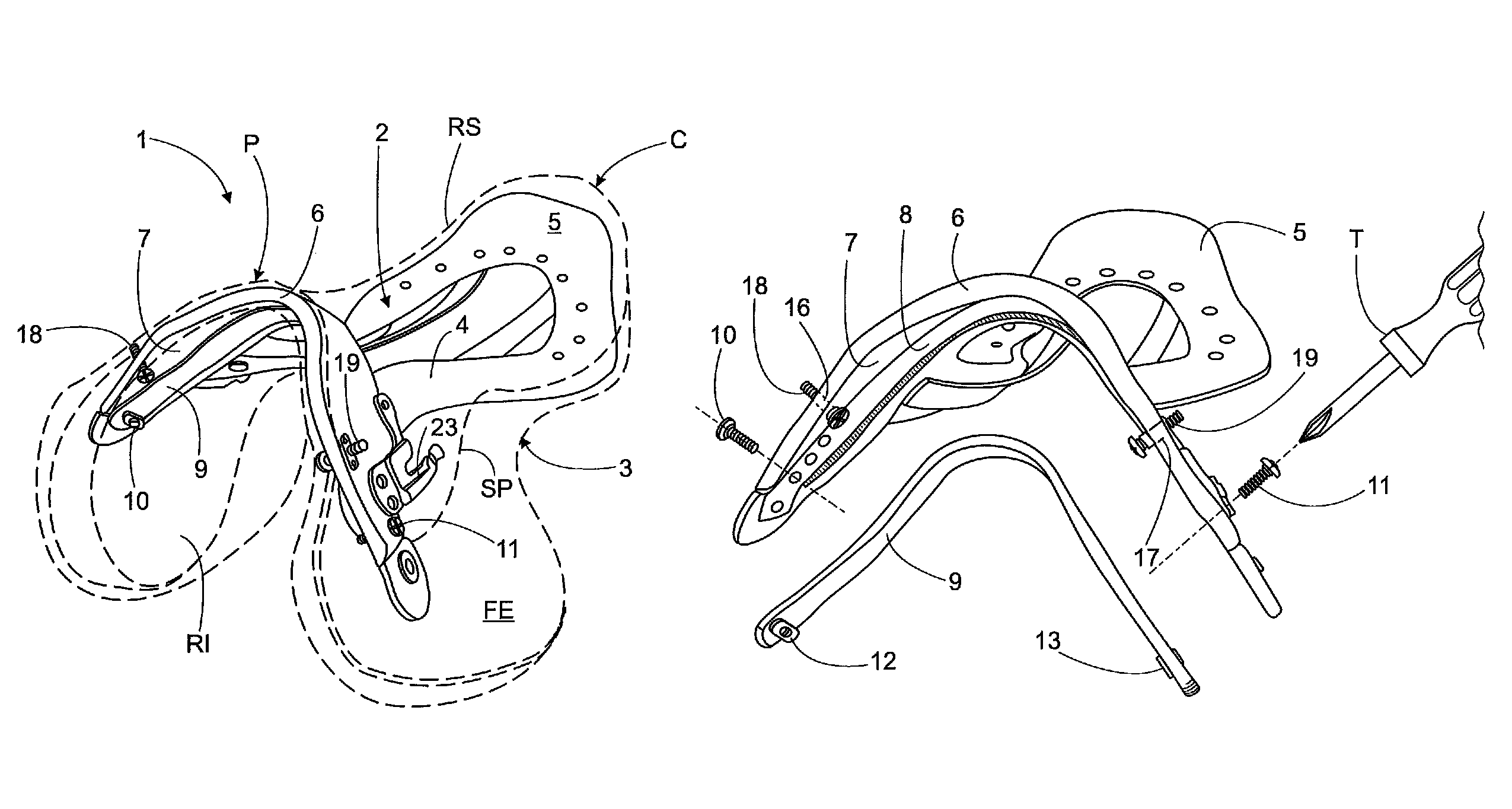 Adjustable saddle