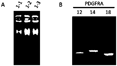 Primer combination and its application for detecting pdgfra gene mutation in trace tissue