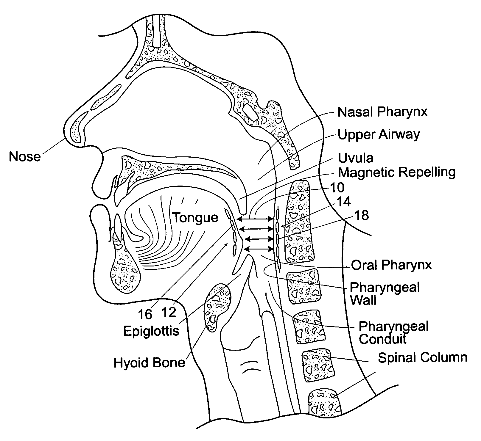 Devices, systems and methods using magnetic force systems in the tongue