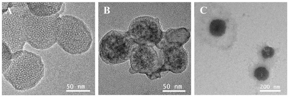 Nano-drug carrier wrapped by bacterial outer membrane vesicles and preparation method of nano-drug carrier