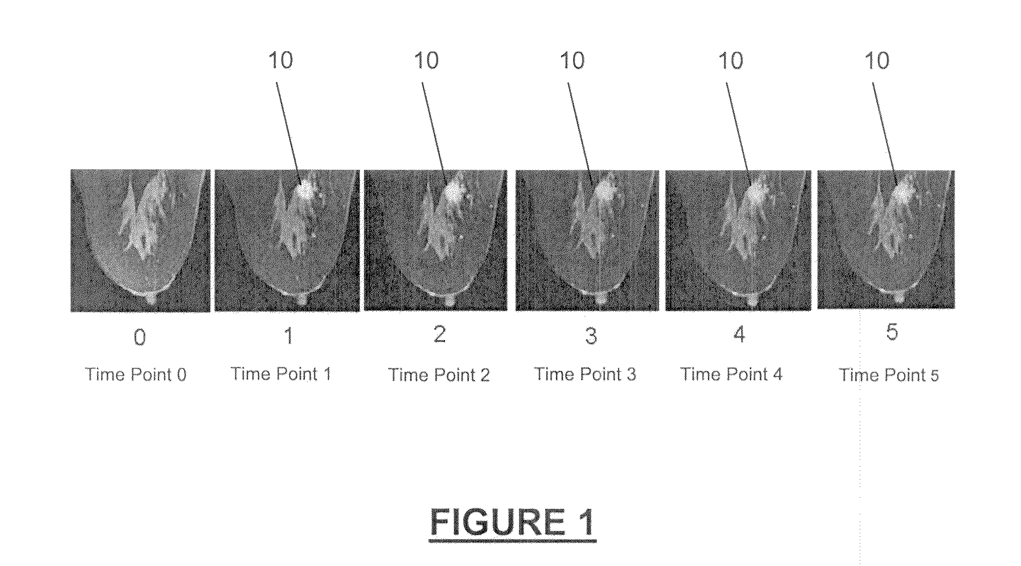 System and method for differentiating benign from malignant contrast-enhanced lesions