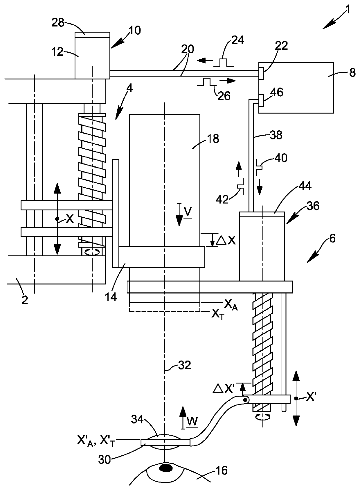 Method for controlling the movement of a vitreoretinal viewing system in an ophthalmic surgical microscope, microscope and motion controller for a microscope