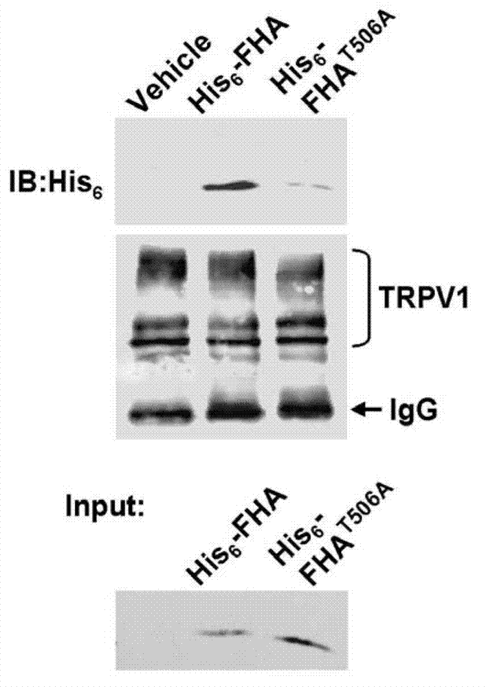 Polypeptide for preventing and/or treating pain and application of polypeptide