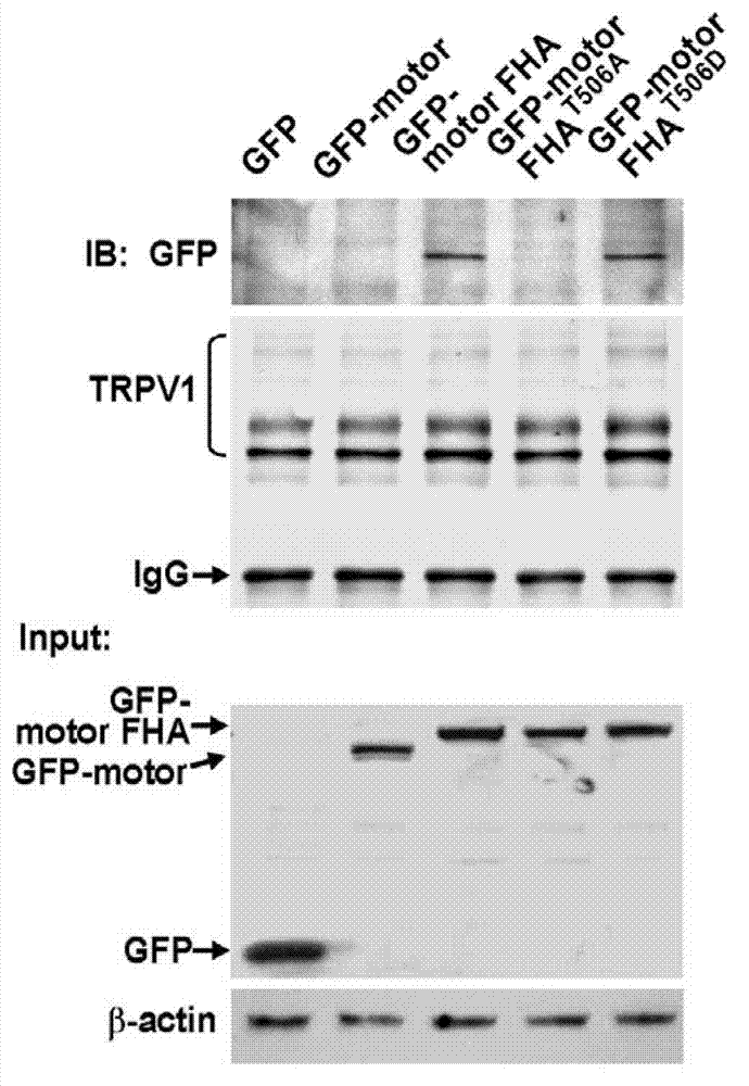 Polypeptide for preventing and/or treating pain and application of polypeptide