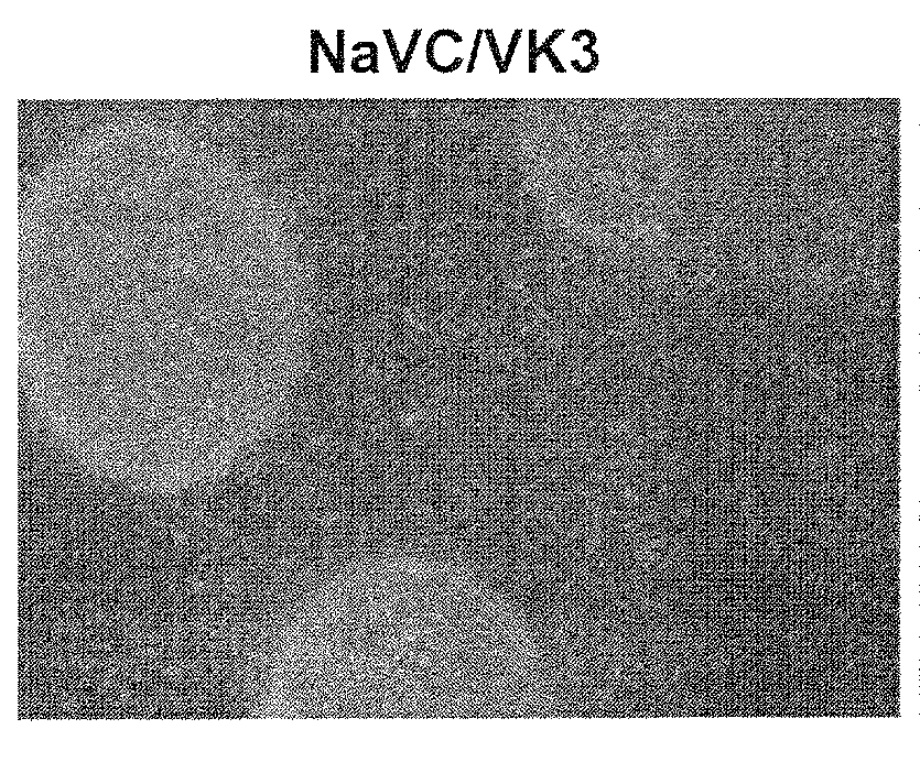 Non-toxic Anti-cancer drug combining ascorbate, magnesium and a naphthoquinone