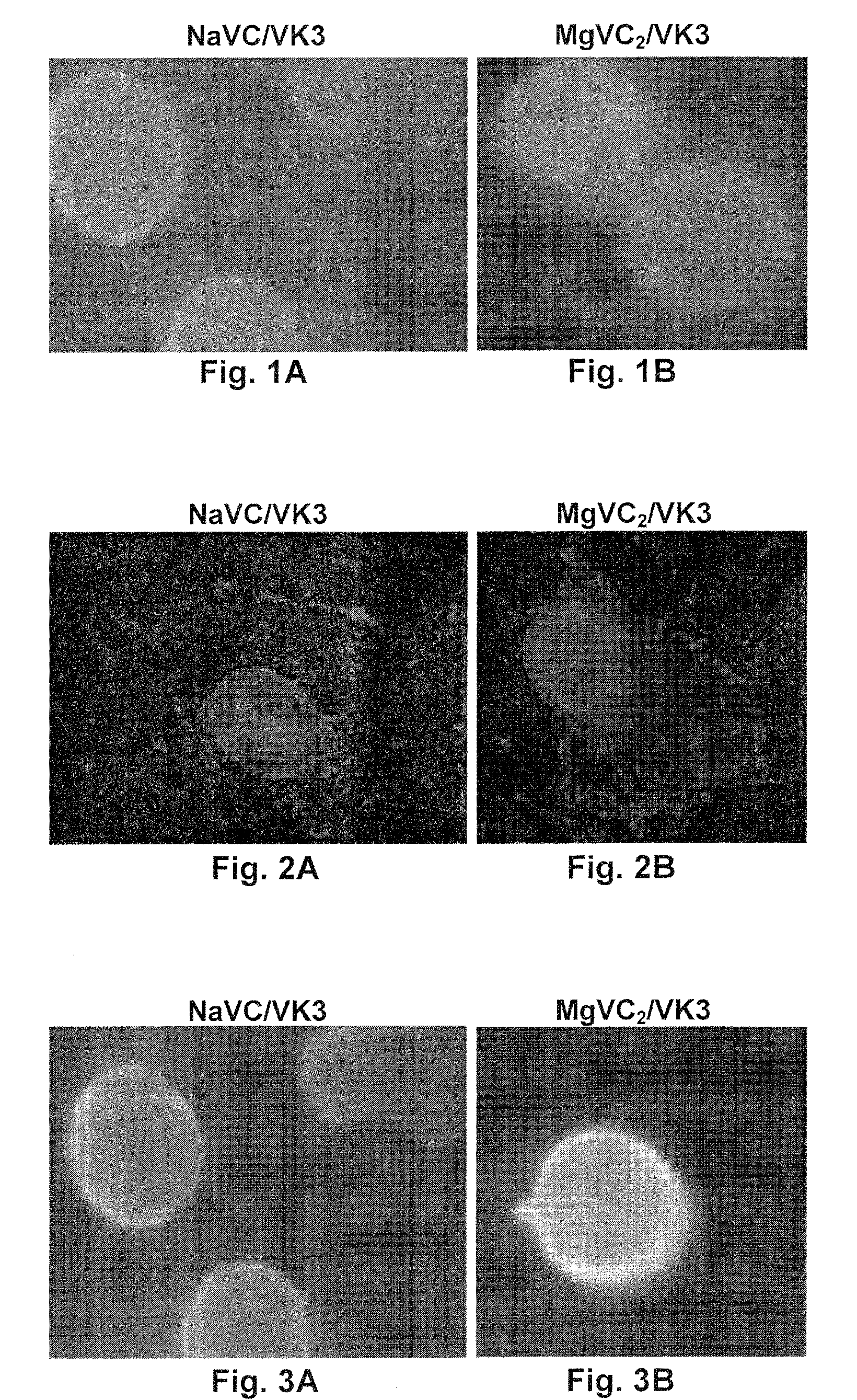 Non-toxic Anti-cancer drug combining ascorbate, magnesium and a naphthoquinone