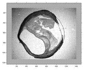 Processing method of atherosclerotic plaque medical image