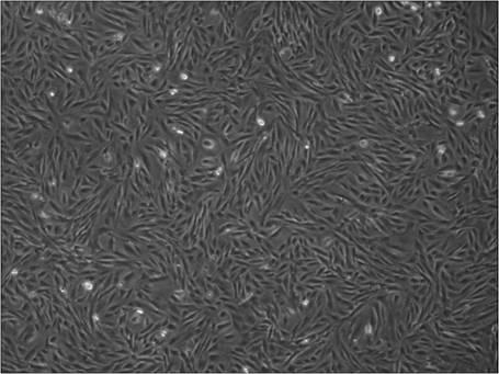Preparation of acellular amniotic membrane carrier combined autologous endometrial stem cells