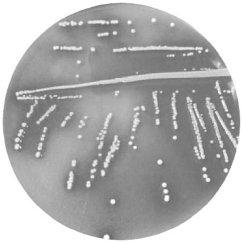 Lactobacillus paracasei and application thereof