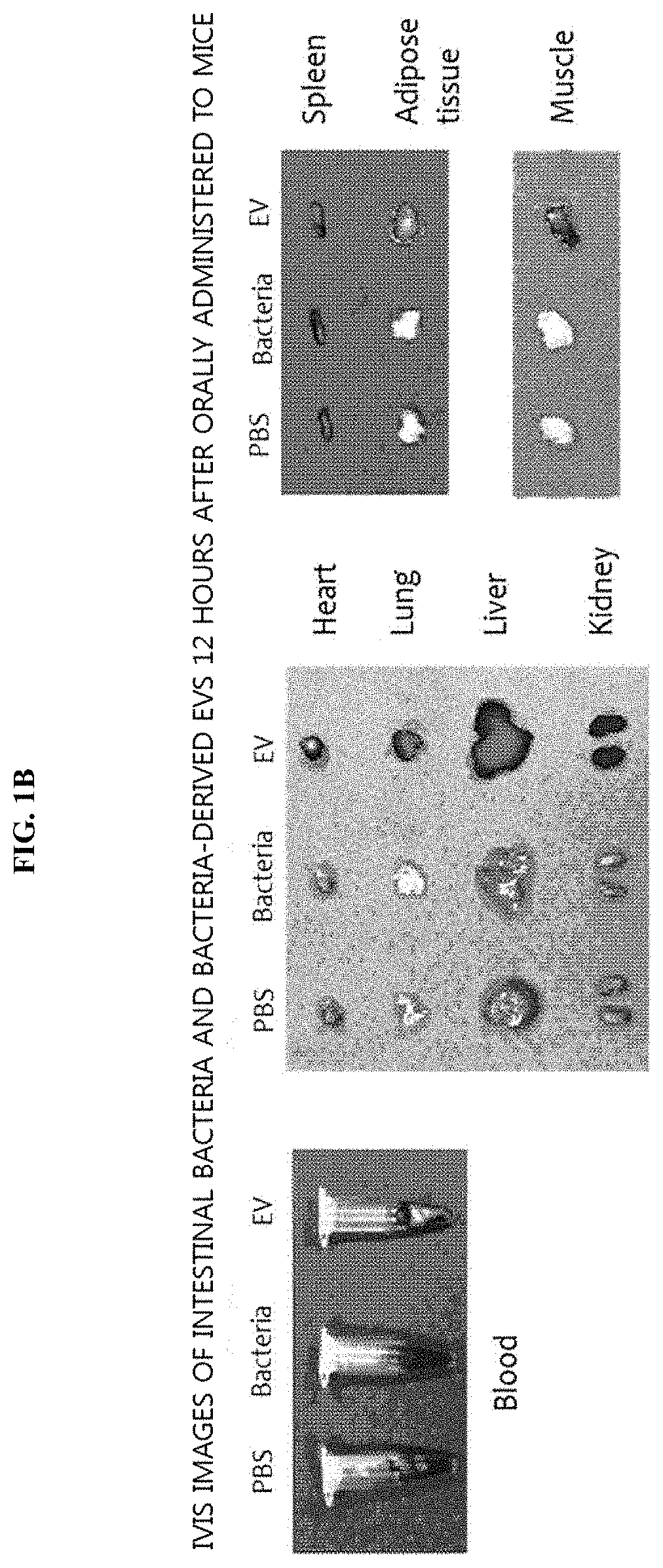 Method for diagnosing head and neck cancer via bacterial metagenomic analysis