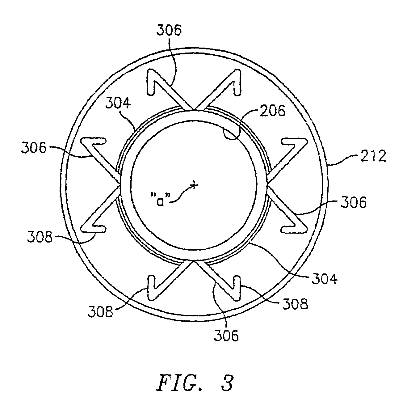 Apparatus and method for fixation of vascular grafts