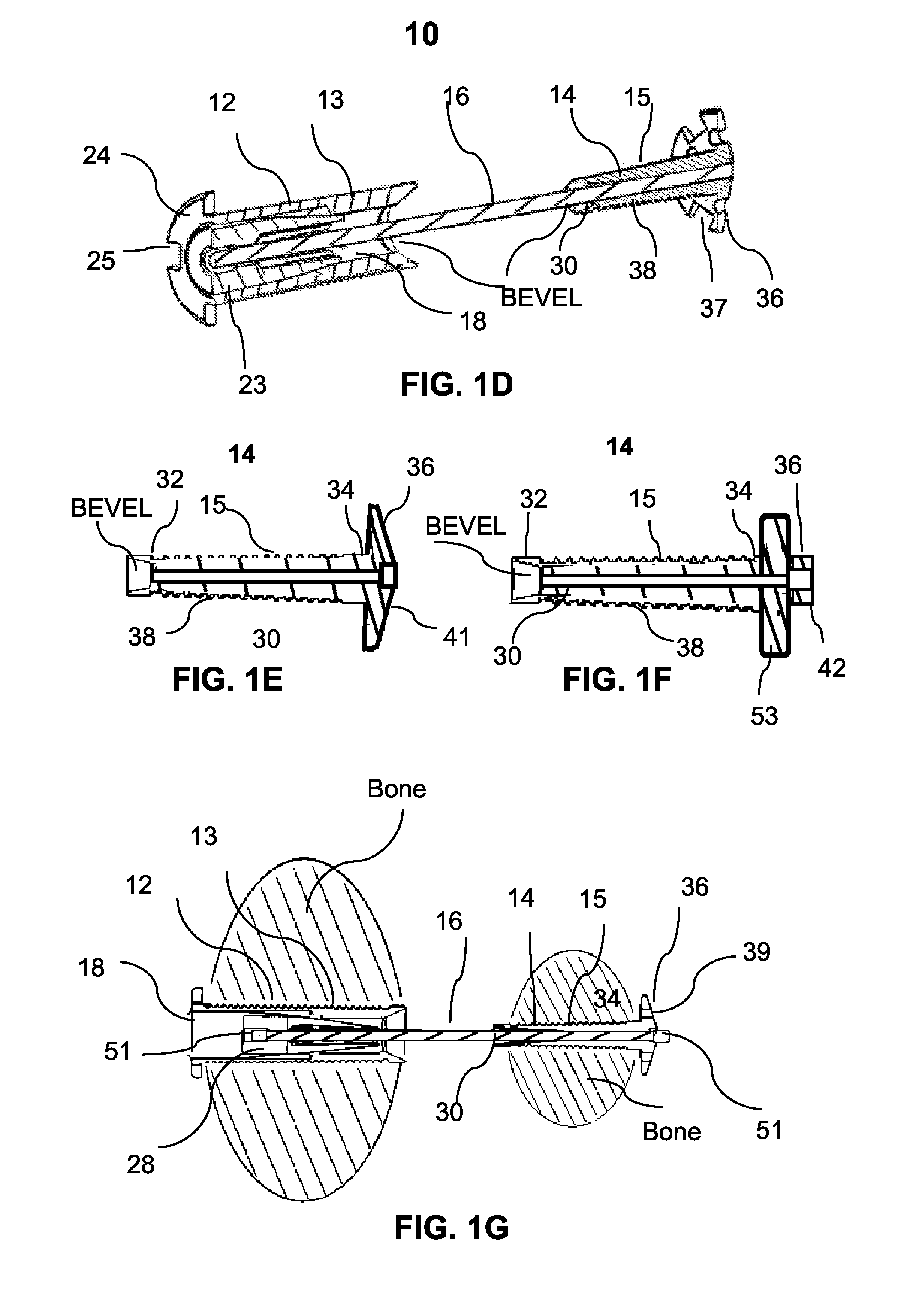 Devices and methods for bone anchoring