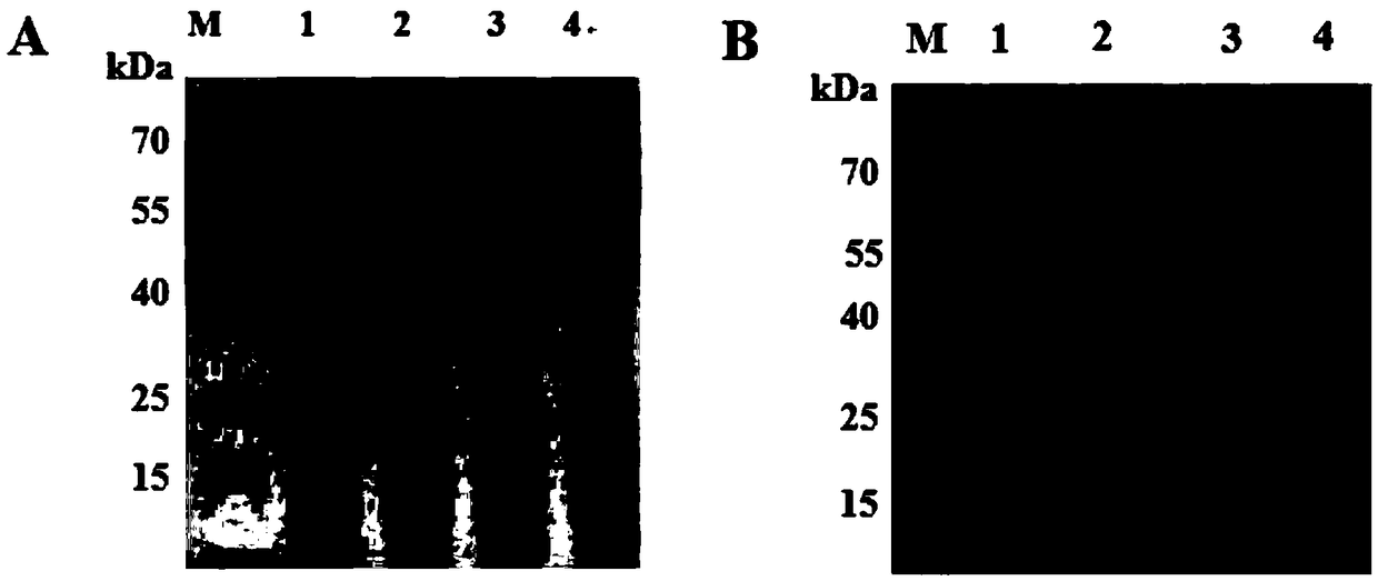 Method for potato leafroll virus (PLRV) detection, and special antibody adopted by method