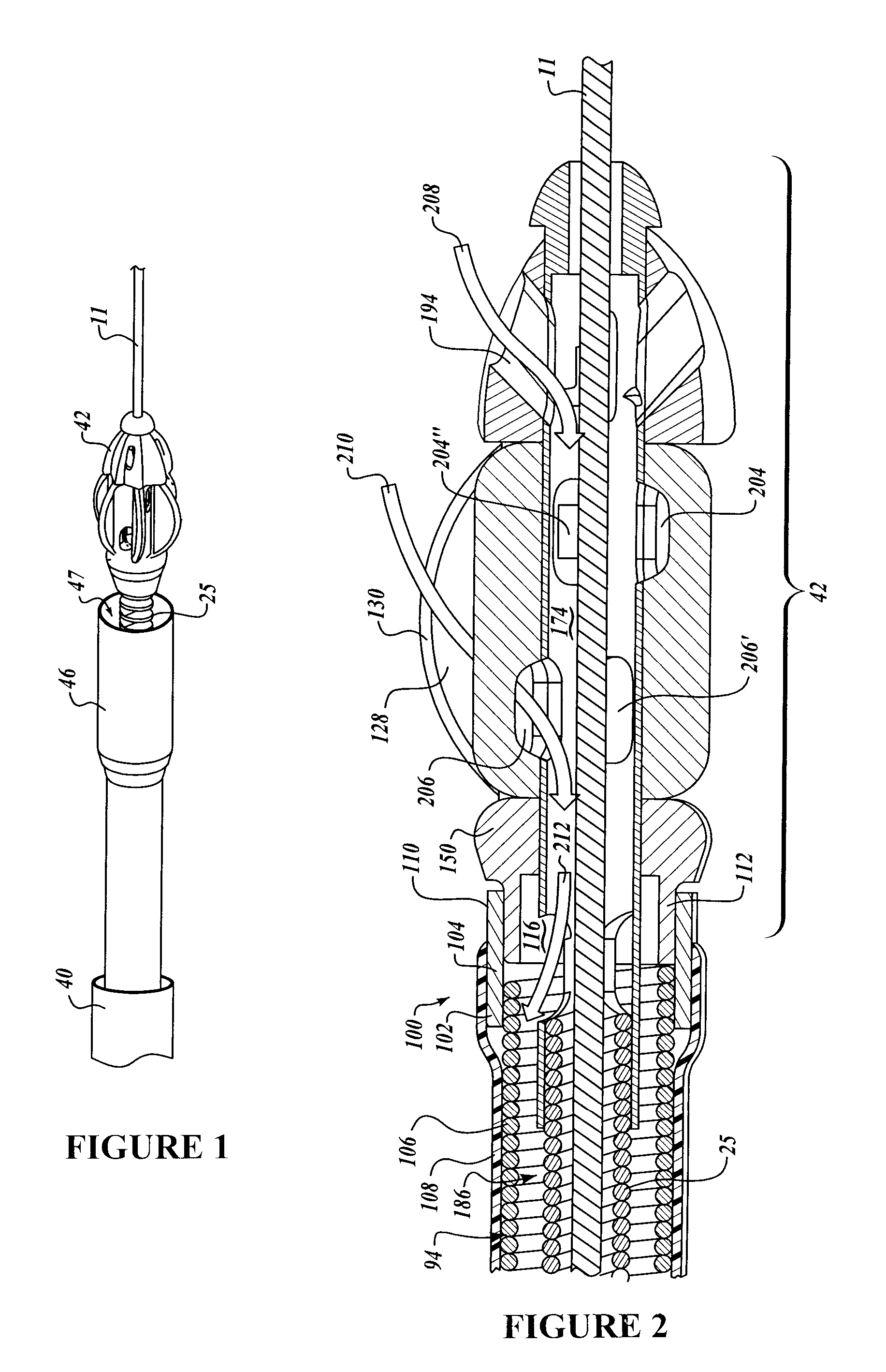 Intralumenal material removal using a cutting device for differential cutting