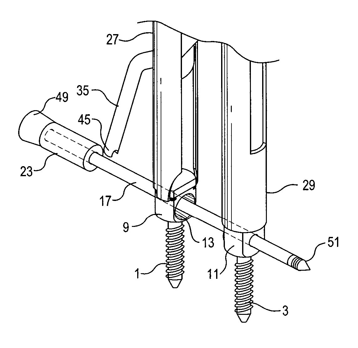 Percutaneous system for dynamic spinal stabilization