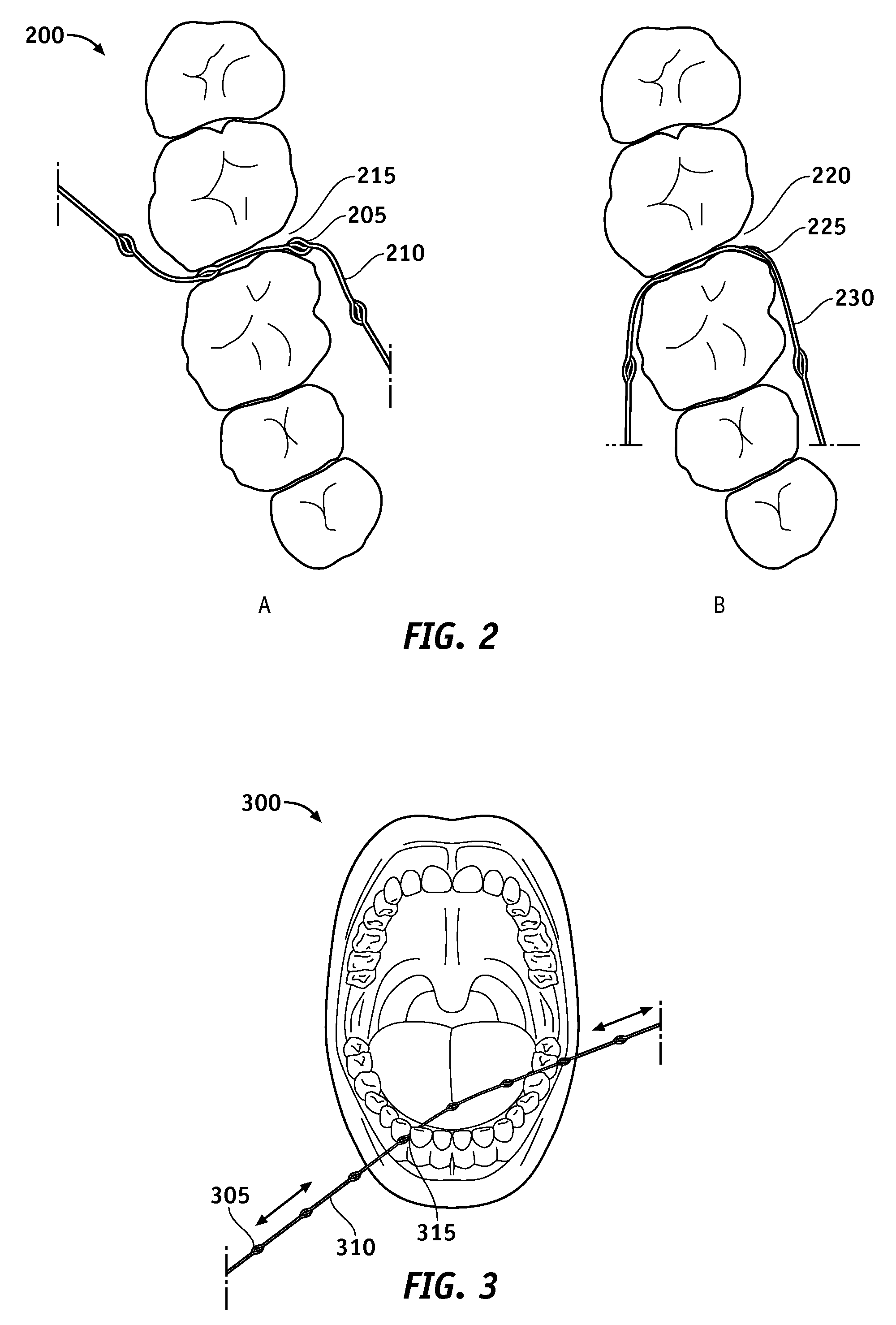 Methods and apparatus for textured dental floss