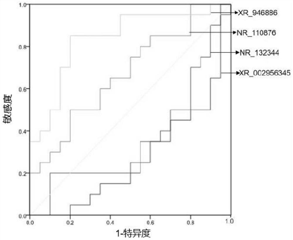 Marker related to abnormal pancreaticobiliary confluence and application thereof