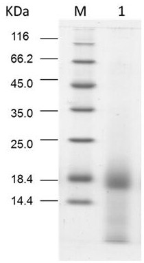 Application of a kind of angelica protein in the preparation of auxiliary tumor therapy drugs