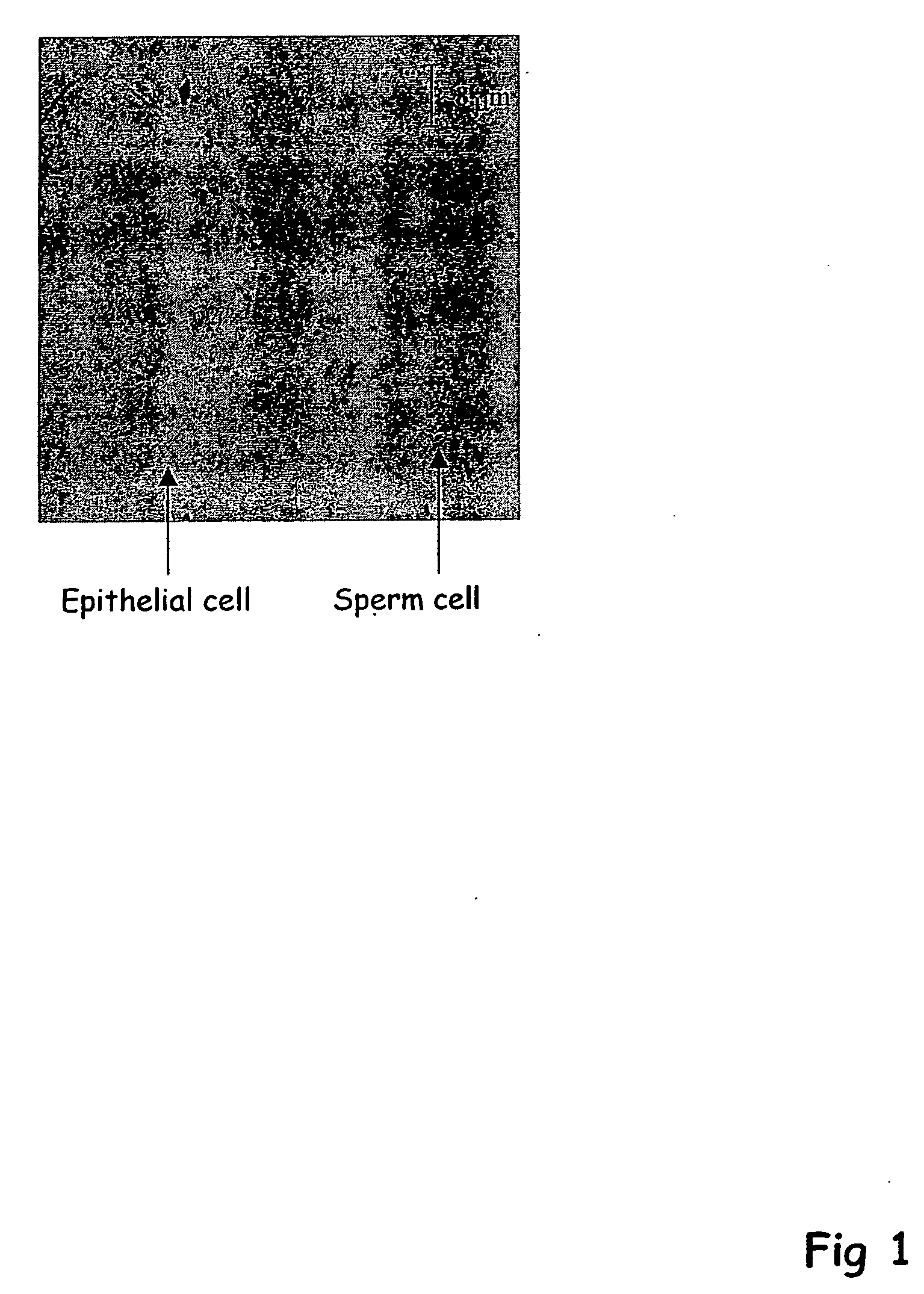 Isolation of sperm cells from other biological materials using microfabricated devices and related methods thereof
