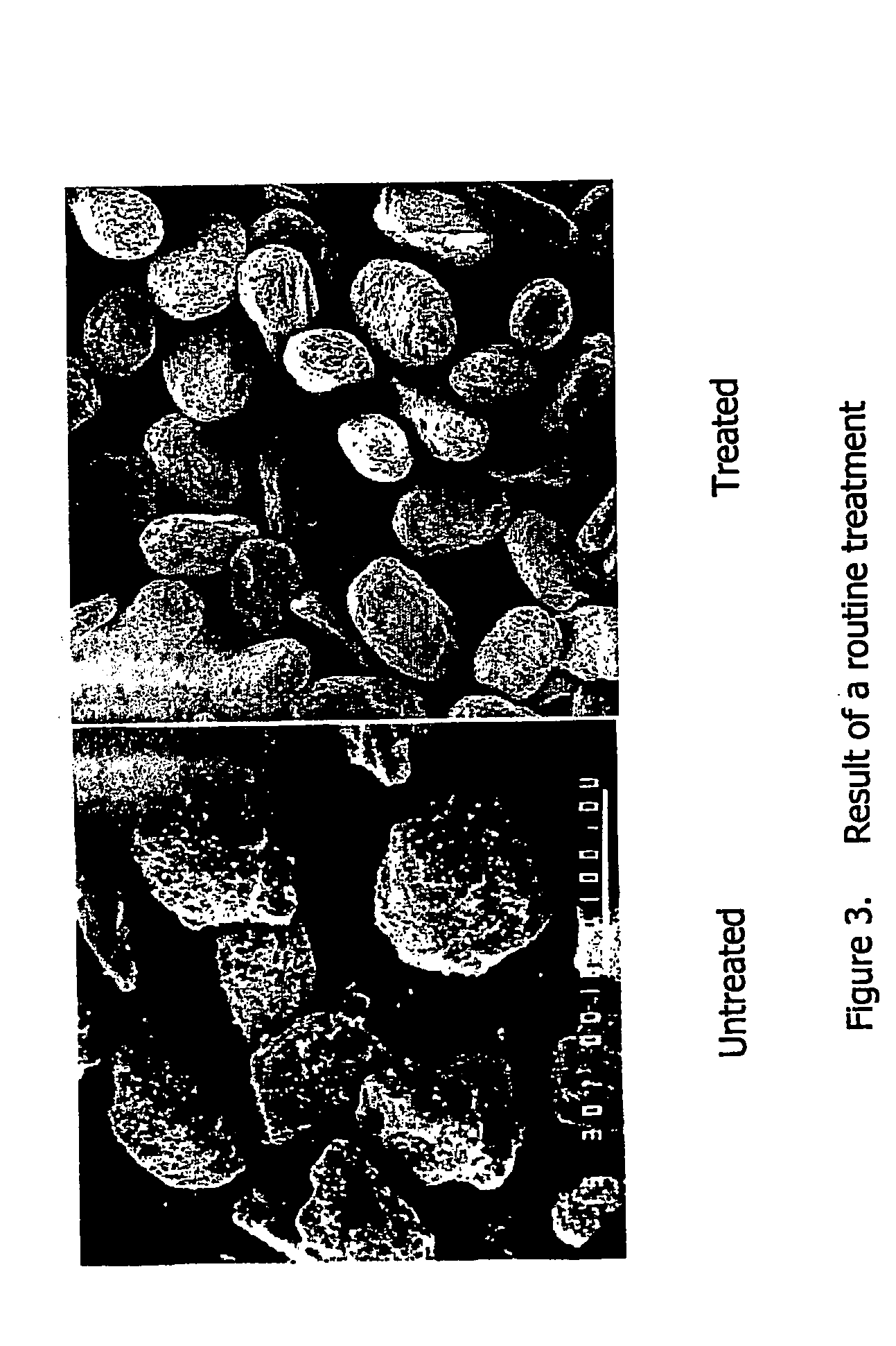Method for treating carrier particles and its use