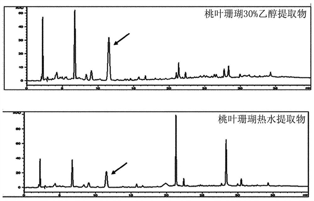 Pharmaceutical composition containing aucuba japonica extract for preventing or treating macular degeneration