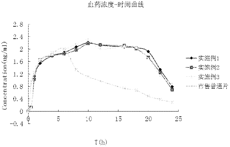 Novel atenolol tablets and preparation method thereof