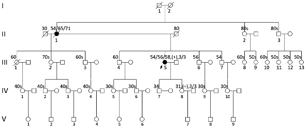 Novel mutation of Alzheimer disease, stable transfer cell model and medical application thereof