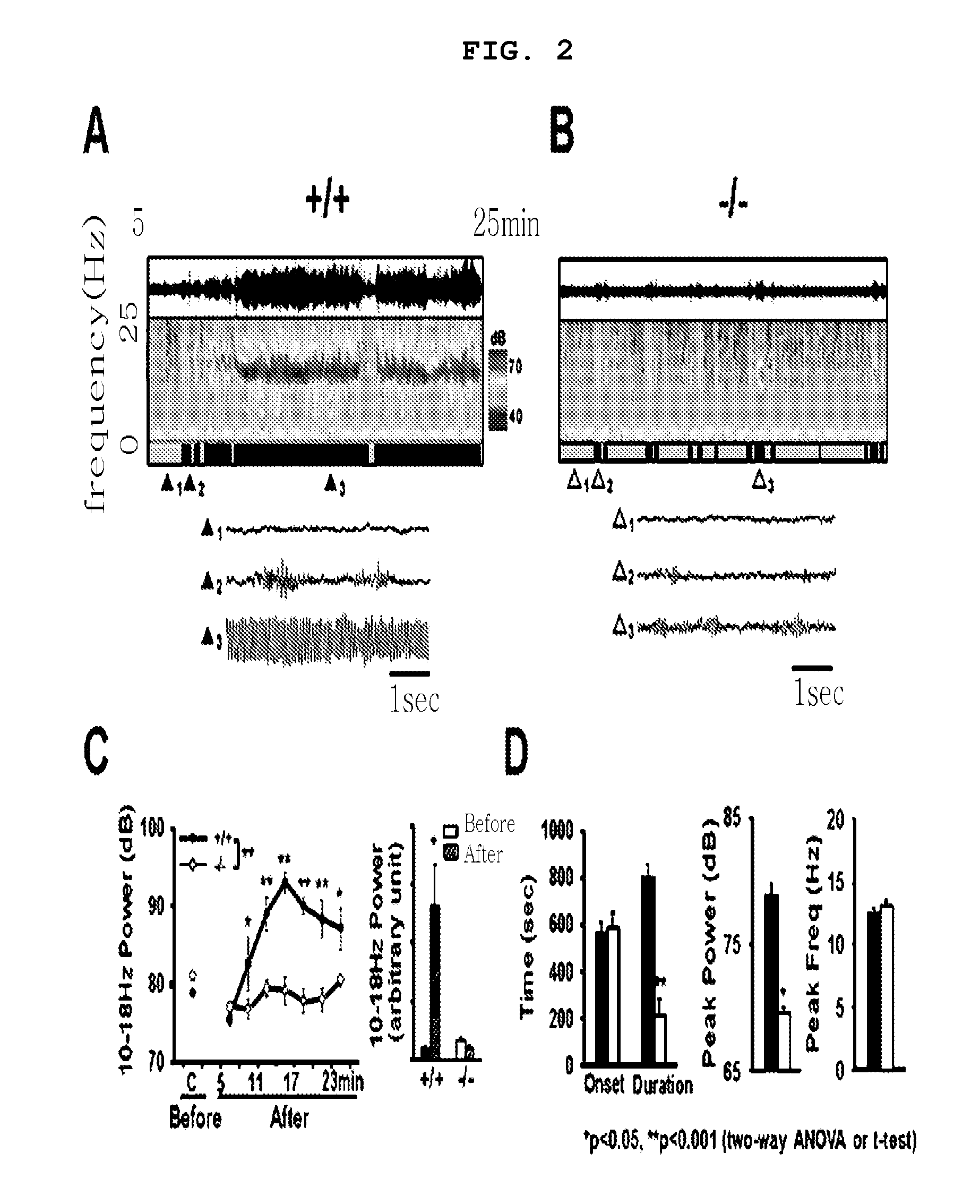 Method for the prevention and treatment of essential tremor by regulating alpha1g t-type calcium channel or by t-type calcium channel blockers