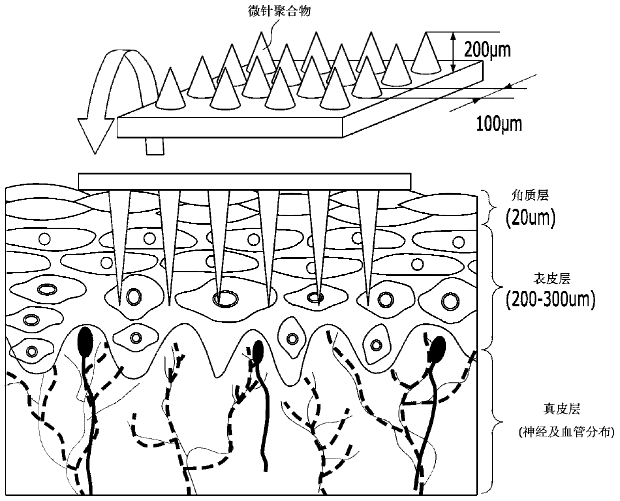 Method for fabricating microneedle-based diagnostic skin patch coated with aptamer and patch