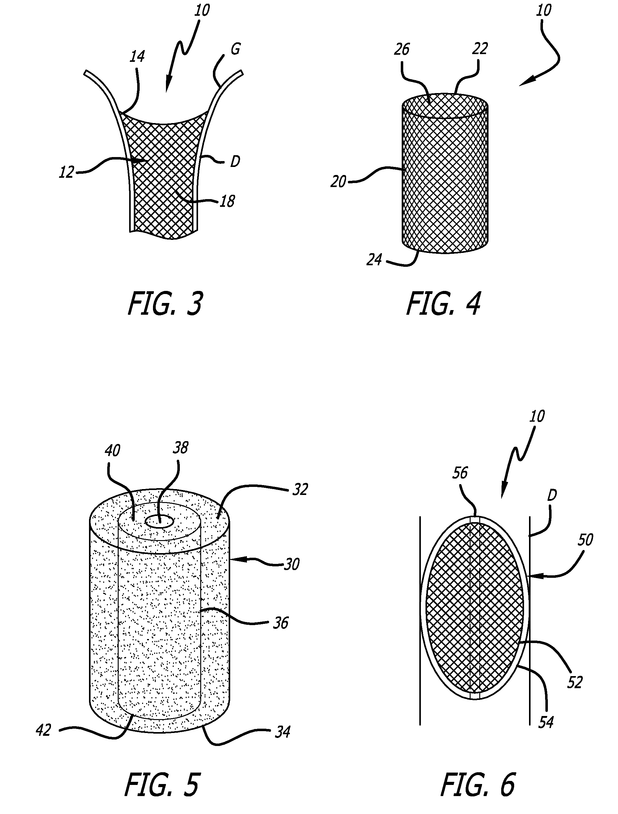 Method And Apparatus For Occluding A Lumen