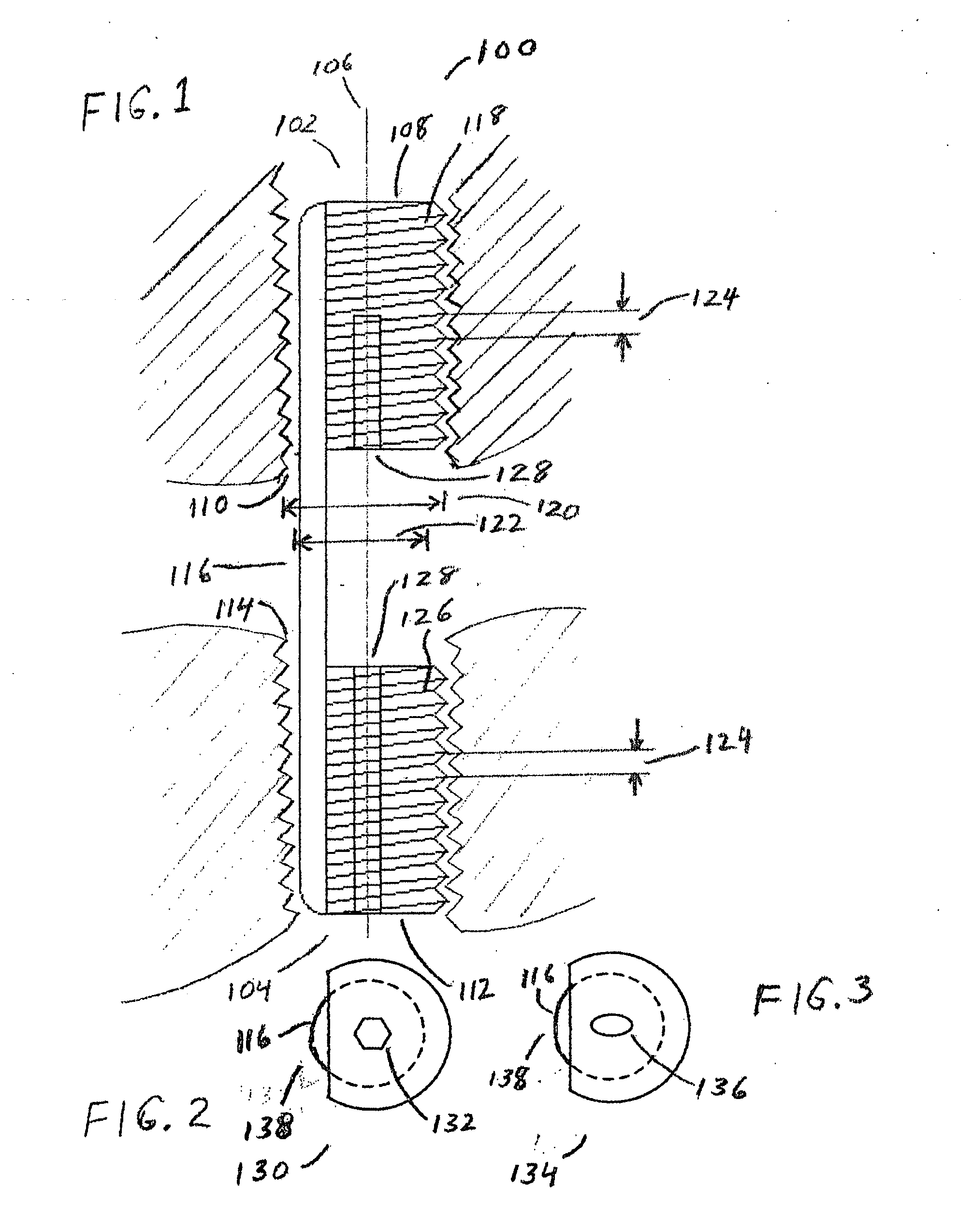 Arthroscopic implants with integral fixation devices and method for use