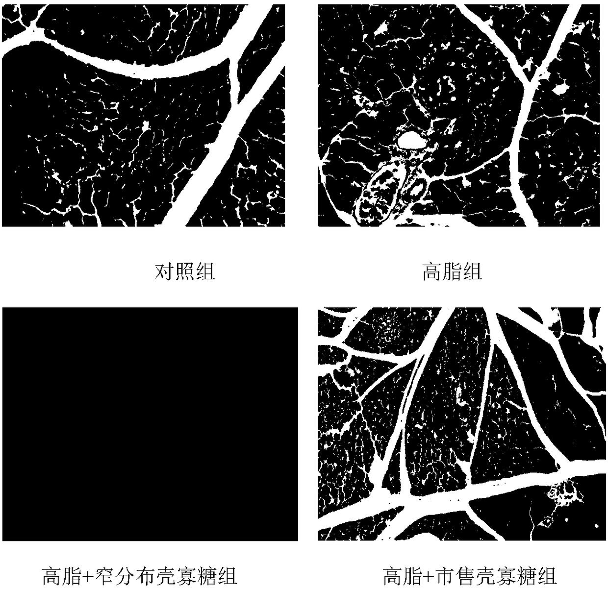 Application of narrow-range chitosan oligosaccharide in preparation of functional food for preventing hyperglycemia induced by long-term high-fat diet