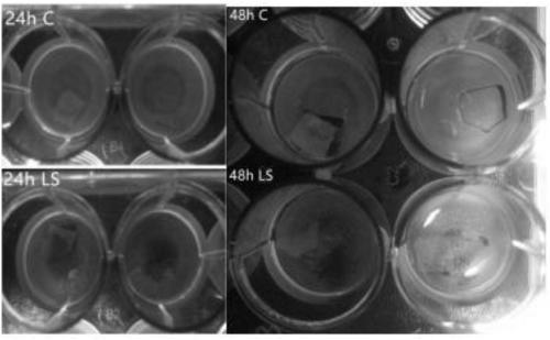 Lactobacillus sialicus and application thereof in down-regulating gene expression of streptococcus mutans biofilm formation