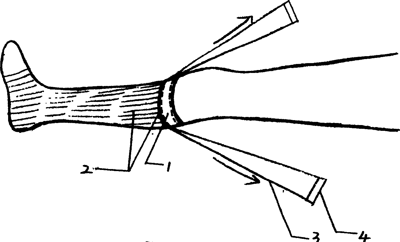 Blood dispelling and hemostasis bandage